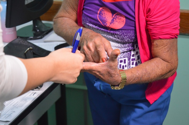 Especialista em dermatologia da Policlínica Codajás alerta para prevenção ao câncer de pele no verão amazônico