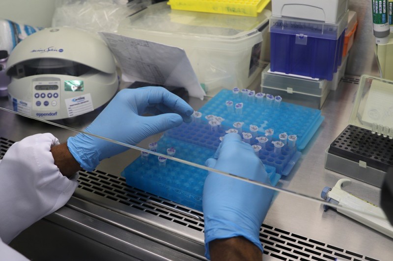 FVS-RCP informa a situação epidemiológica da Covid-19 no Amazonas, nesta quarta-feira (13/10)